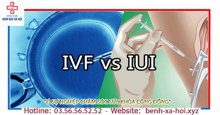 Phân biệt IUI và IVF - So Sánh Phương Pháp Điều Trị Vô Sinh Hiếm Muộn